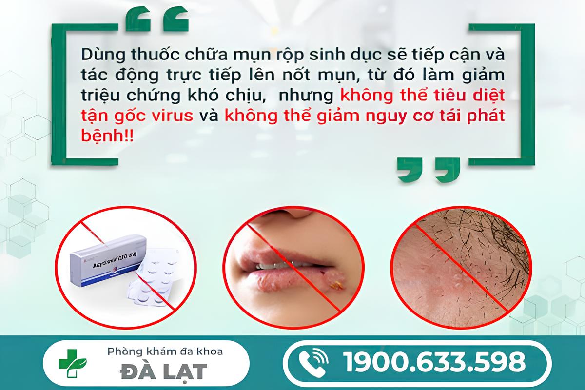 Hình ảnh minh họa